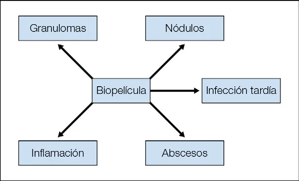 Esquema del abanico clínico de la biopelícula: del centro salen cinco flechas hacia granulomas, nódulos, infección tardía, abscesos e inflamación. Un solo mecanismo explica cinco diagnósticos que durante años se trataron como entidades distintas, y por eso el corticoide llegó a ser primera línea en algunos de ellos. Carruthers, Aumento de tejidos blandos, figura 26.4.
